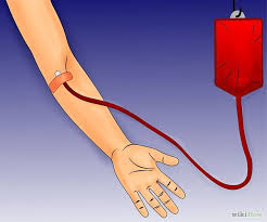 Concepto de transfusión